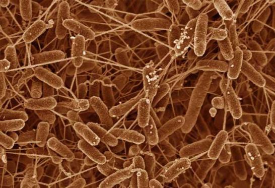 La bacteria que protagonizó el estudio se llama Geobacter sulfurreducens, considerado uno de los microorganismos más promisorios a la hora de pensar en nuevas alternativas energéticas. 